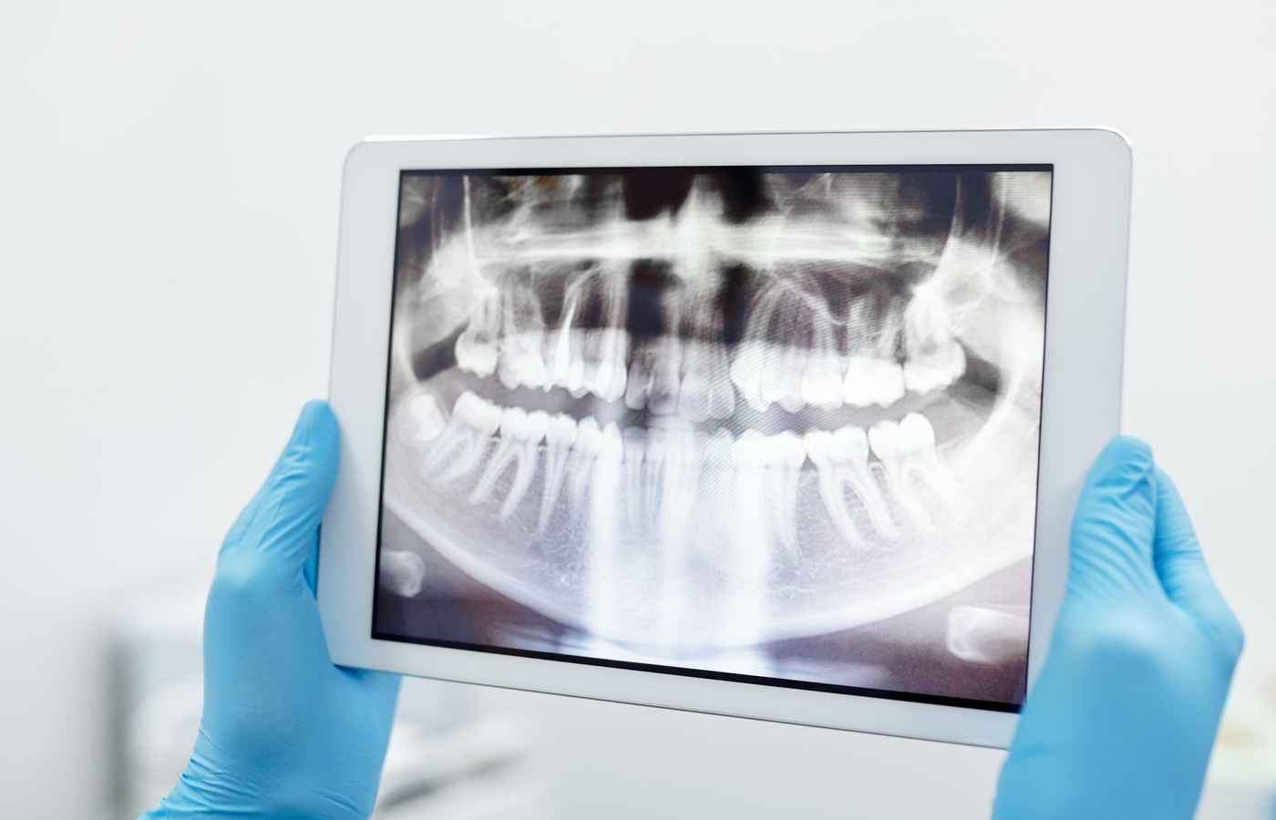 ADAA X-Ray