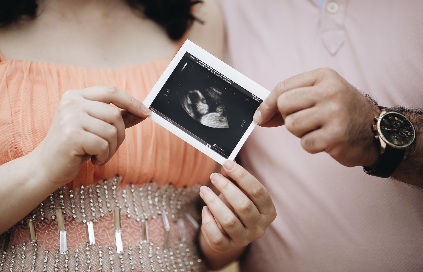 Abdominal Focused Assessment with Sonography for Trauma (AFAST)
