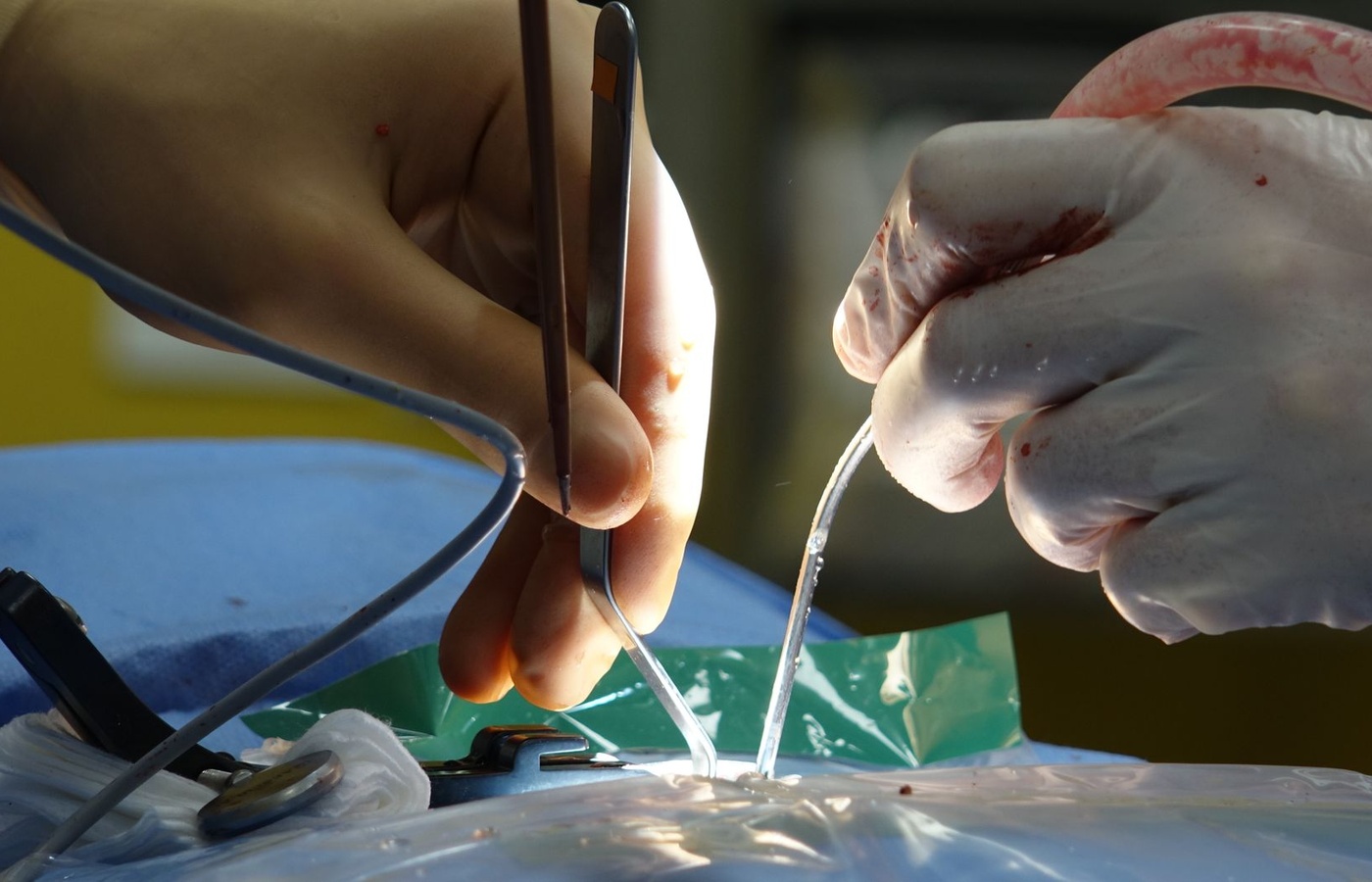 Advanced Trauma Life Support (ATLS)