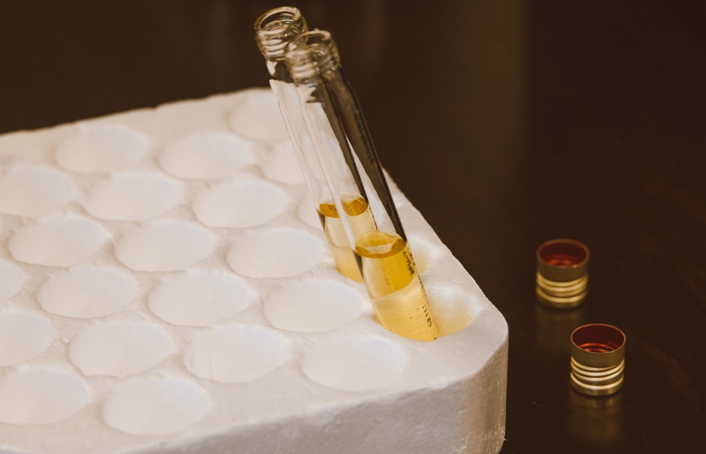 Analysis of Urine and Body Fluids (AUBF) – Urinary Sediments