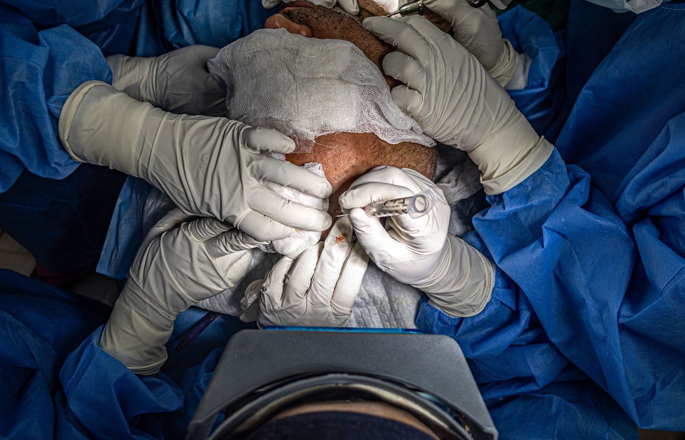 Breast, Chest Wall, and Thoracic Surgery
