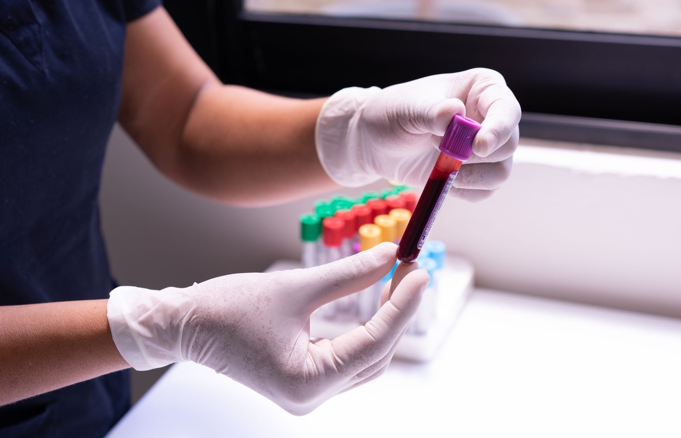 California Phlebotomy Certification