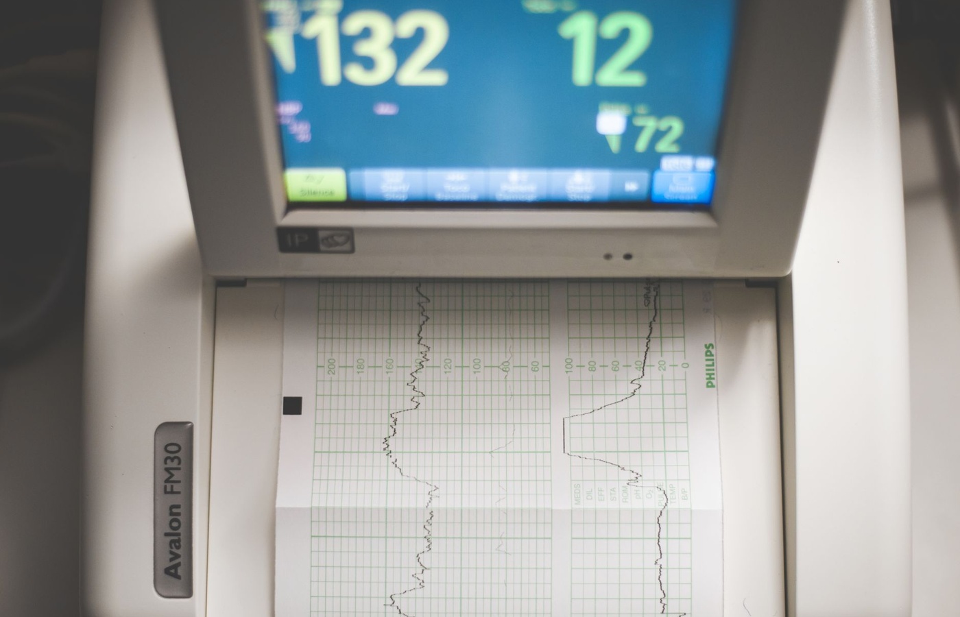 Cardiovascular Dynamics Lab