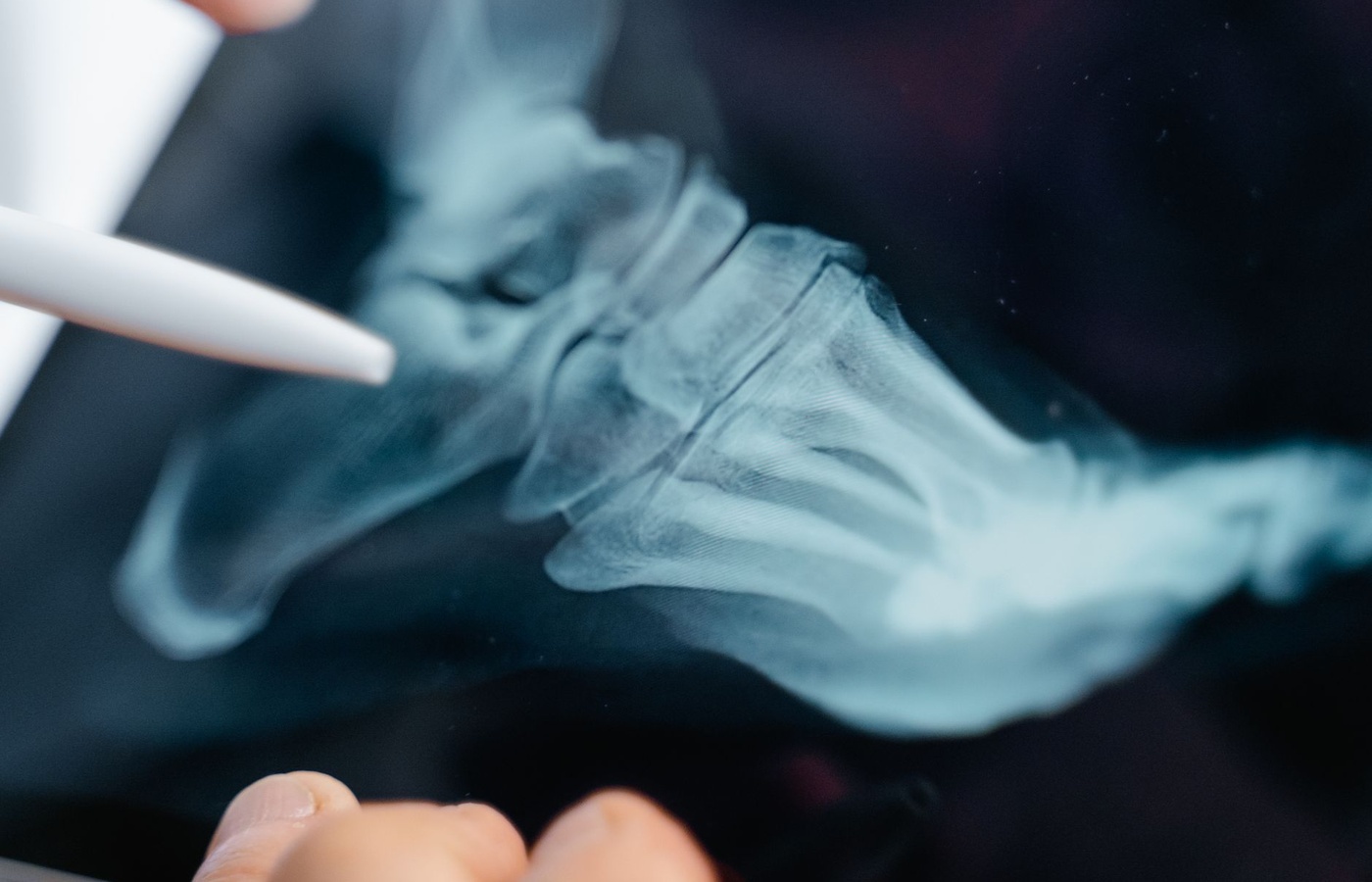 Clover Learning Radiography Image Evaluation and Quality Control