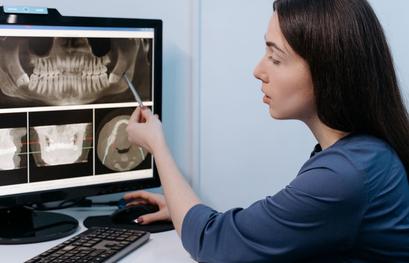 Clover Learning Radiography Positioning for the Spine