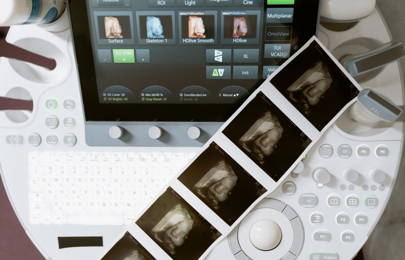 Echocardiography Exam 2