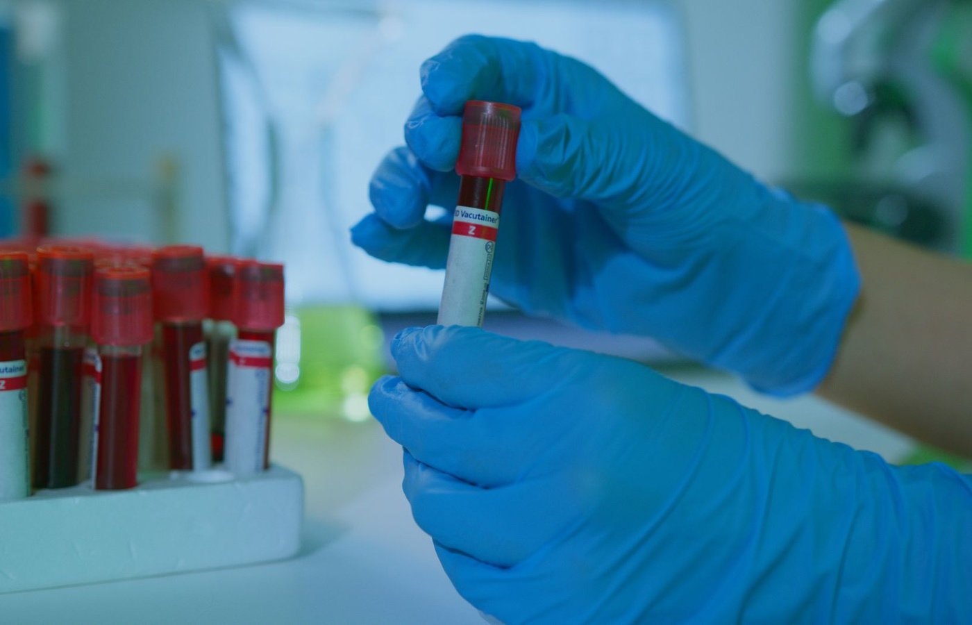 EDAPT Clotting