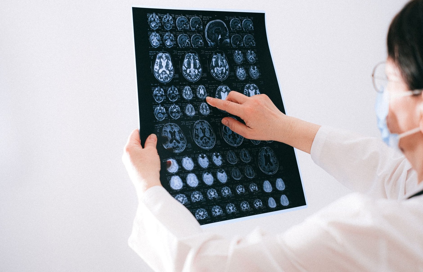 EDAPT Intracranial Regulation