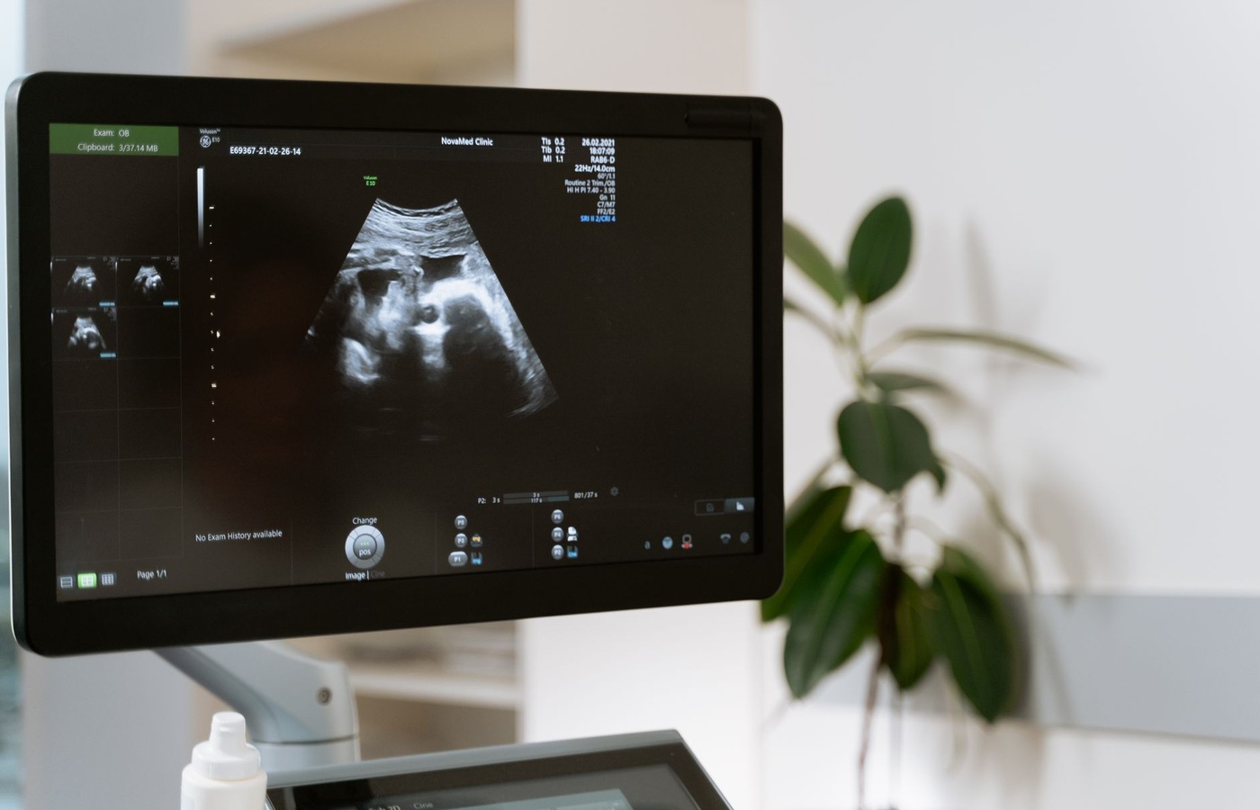 Diagnostic Medical Sonography Program – Exam One: Applied II Practice