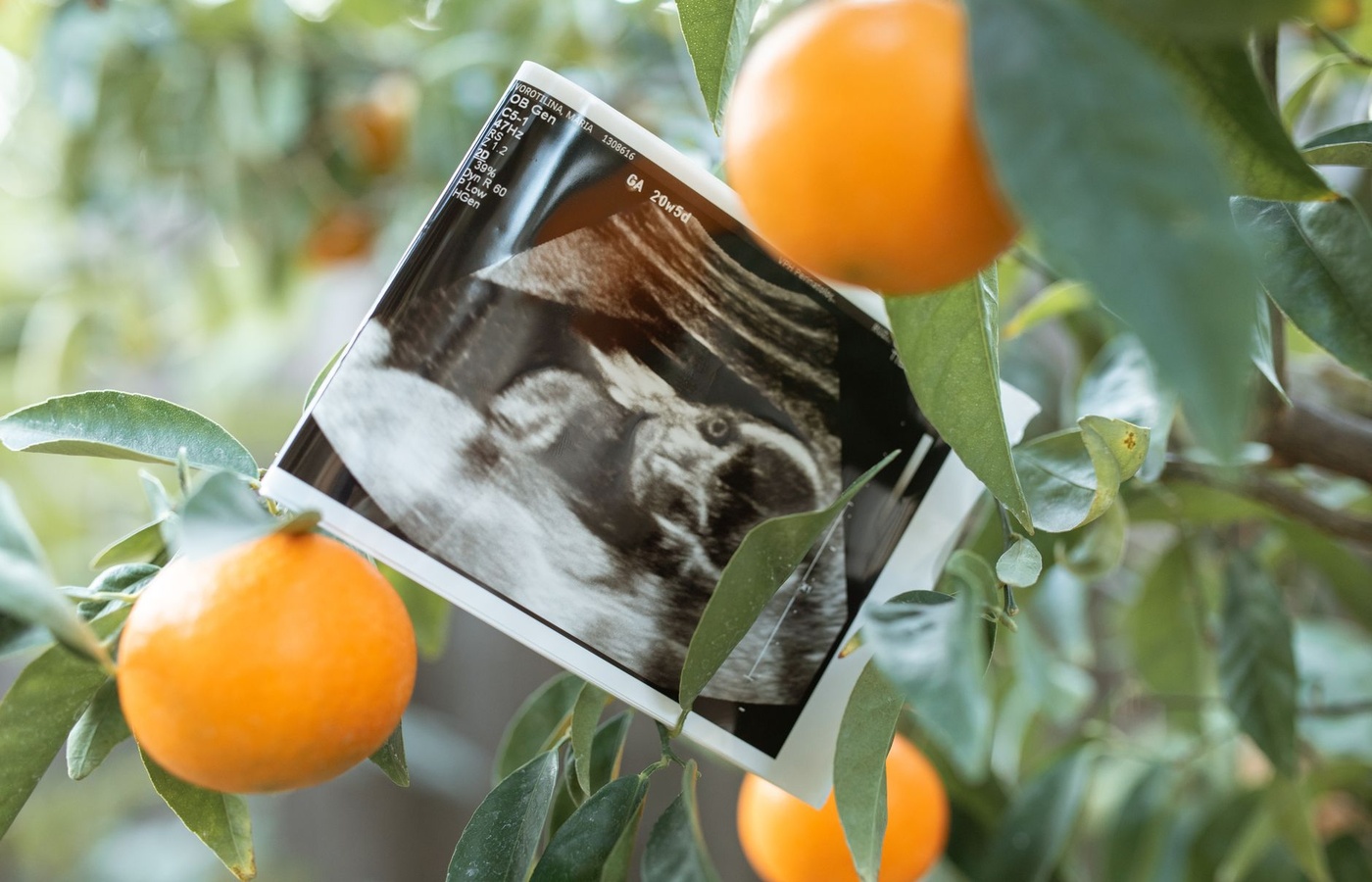 Liver Anatomy, Function, and Ultrasound Principles for Medical Students