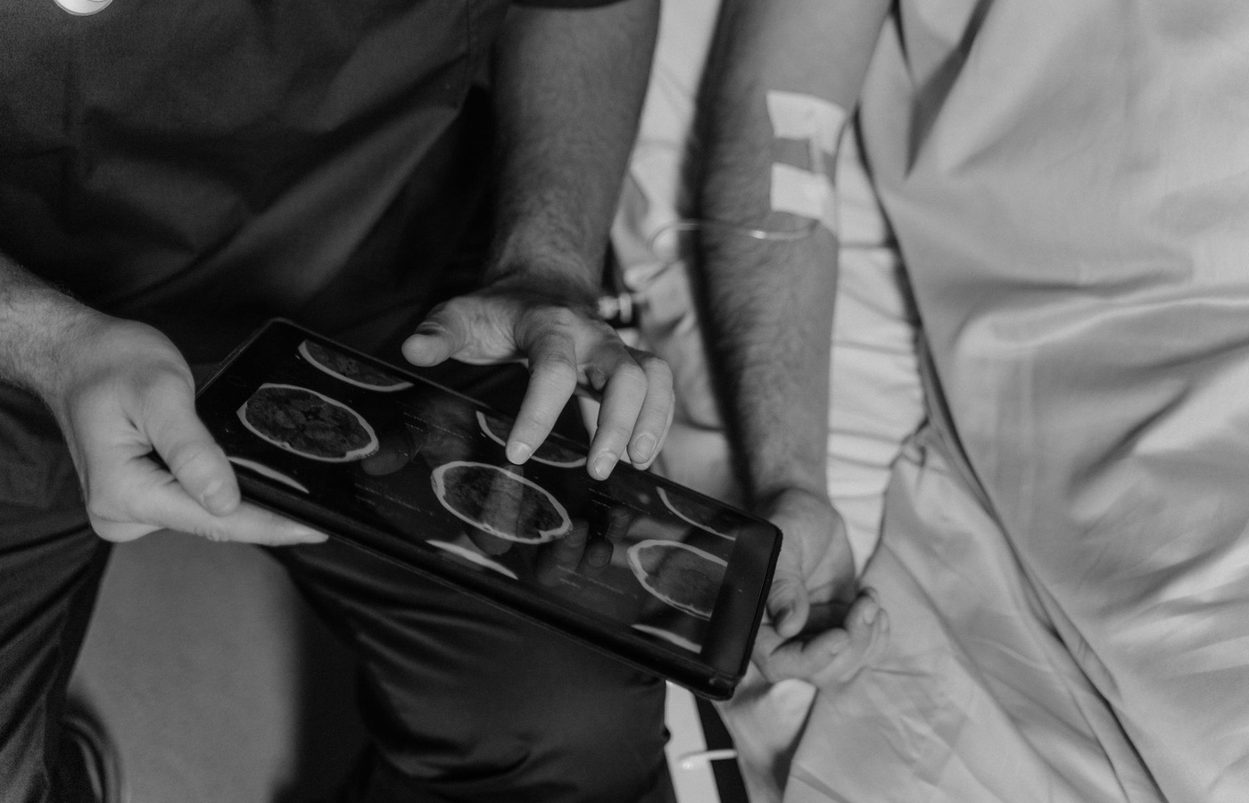 Moderate-Severe Traumatic Brain Injury (TBI)