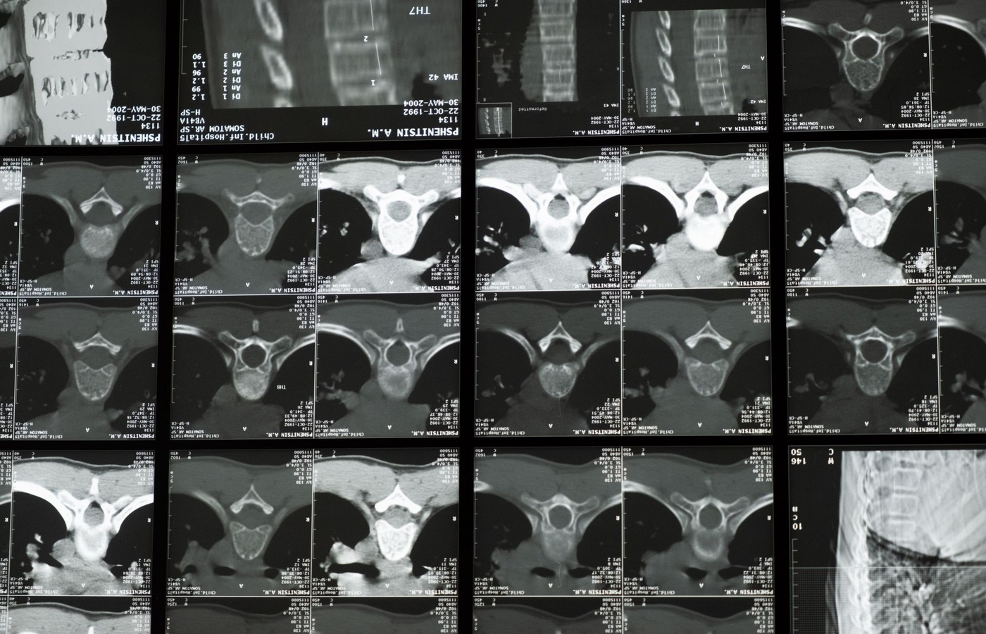 Magnetic Resonance Imaging (MRI) Board