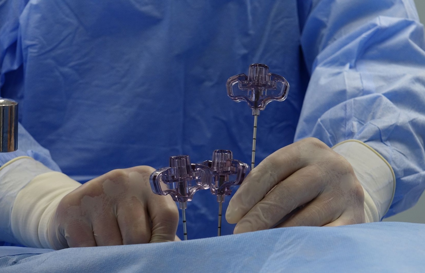 NM3 Spinal Cord Injury (SCI)