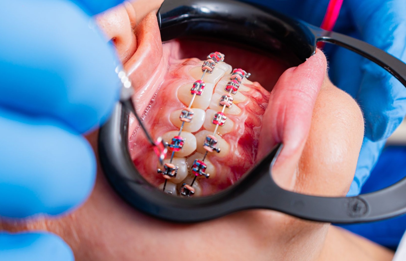 Orthodontics OSCE