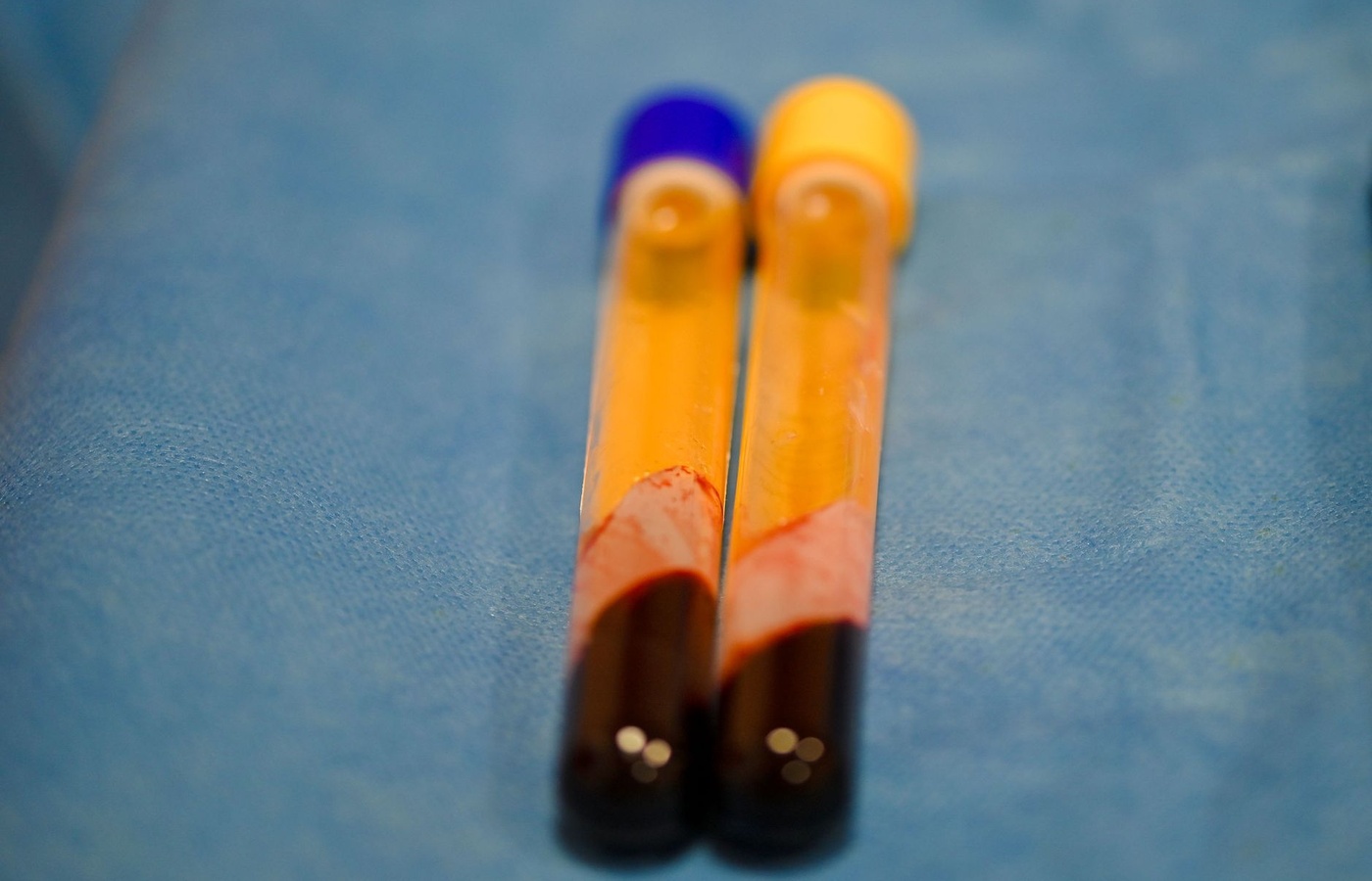 Phlebotomy – Order of Draw