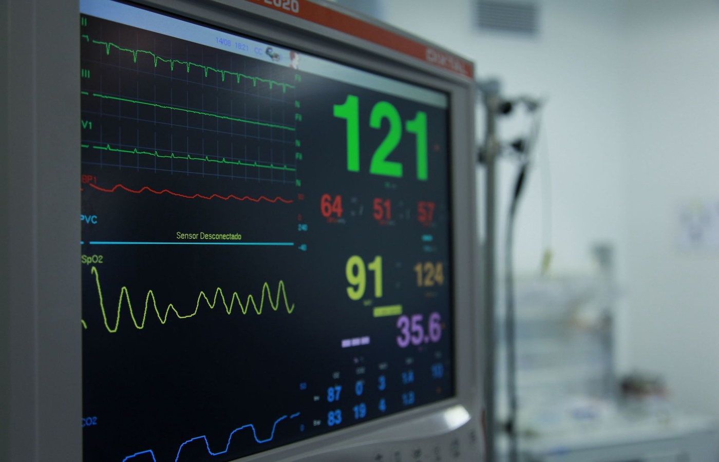Rapid Interpretation of EKGs