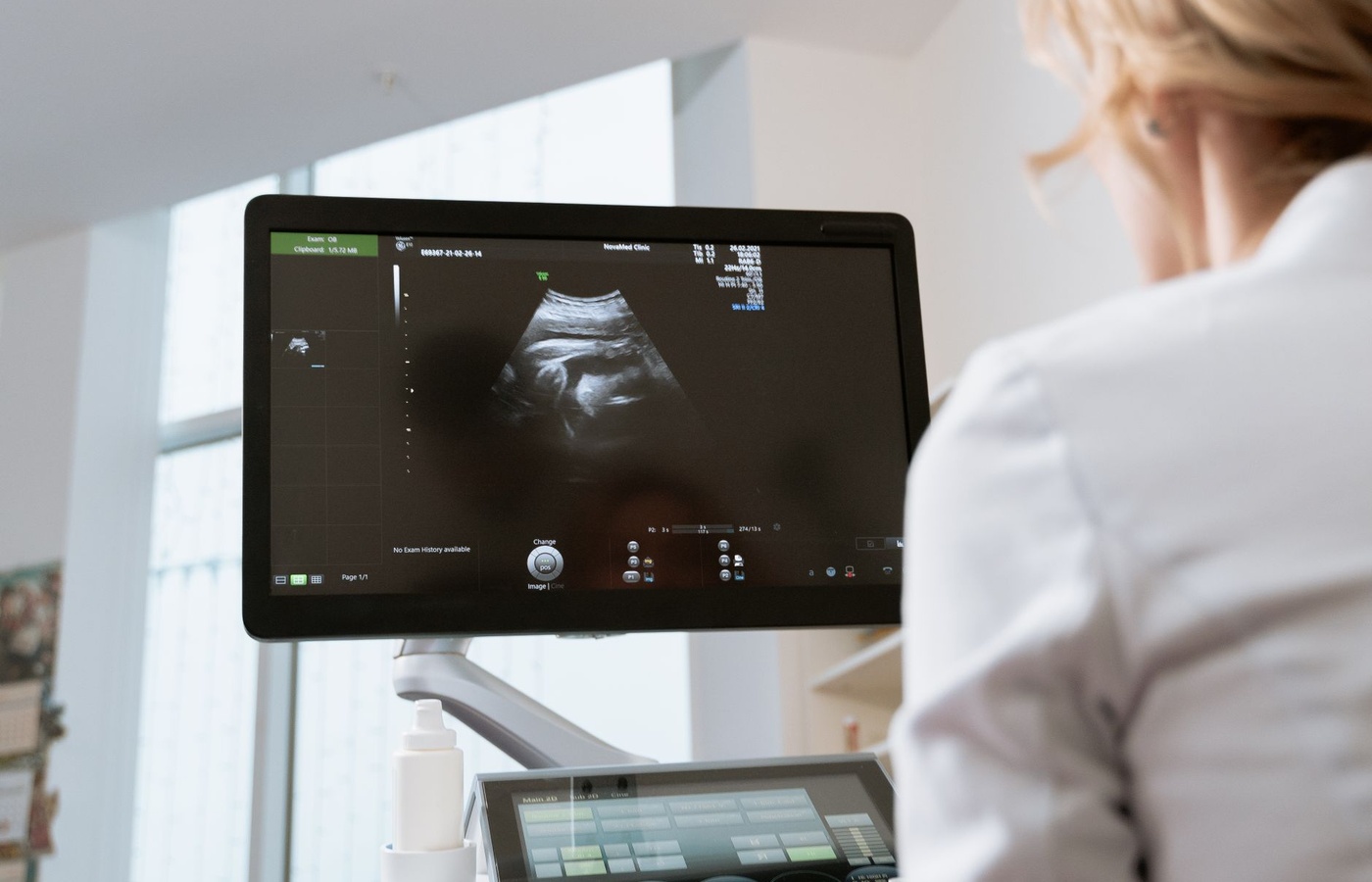 Ultrasound Vascular Registry