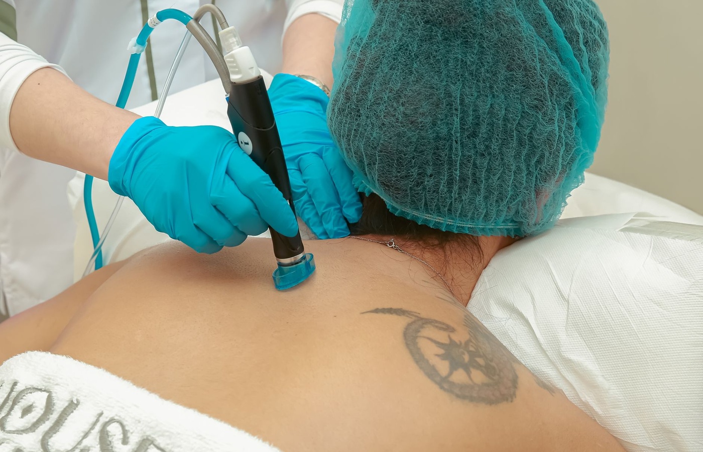 Written Laser Hair Removal
